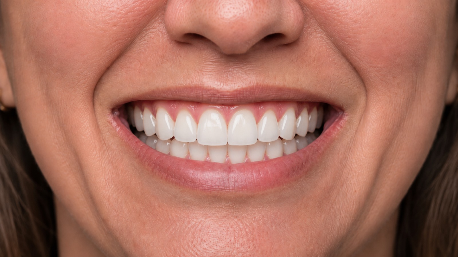 After — a healthy, fully restored smile